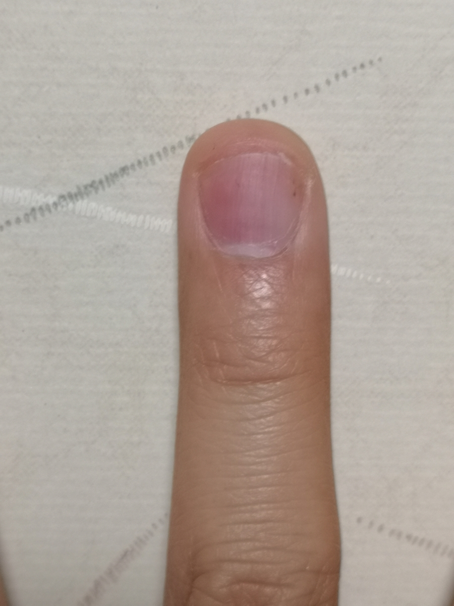 f:id:tsurutsuru-co-jp:20201028222050j:plain f:id:tsurutsuru-co-jp:20201028222050j:plain