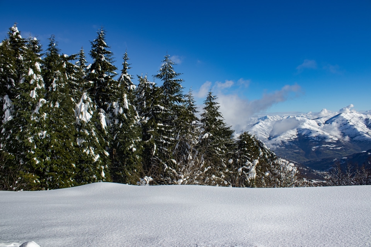 【ヒゲ脱毛】15回目のヒゲ脱毛、効果はかなり出ているらしい