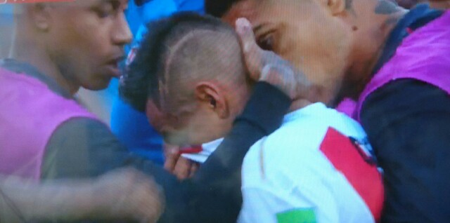 f:id:tukkoman:20180726091822j:image