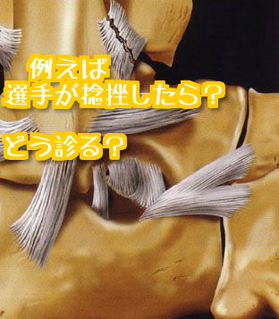 f:id:tumh-step:20170117154512j:plain f:id:tumh-step:20170117154512j:plain