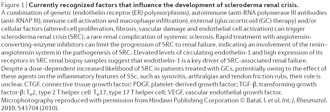 f:id:tuneYoshida:20190513132405p:plain