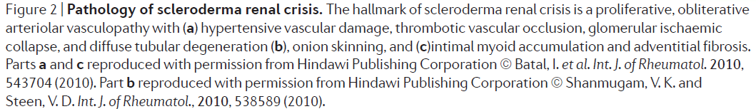 f:id:tuneYoshida:20190513134300p:plain