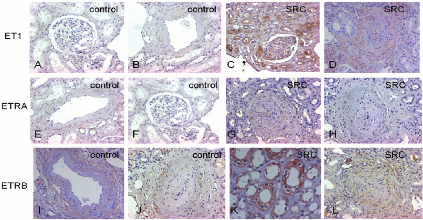 f:id:tuneYoshida:20190513140620p:plain