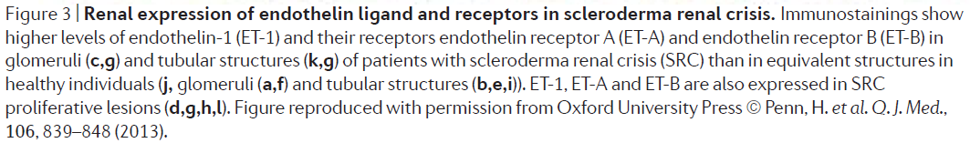 f:id:tuneYoshida:20190513140659p:plain
