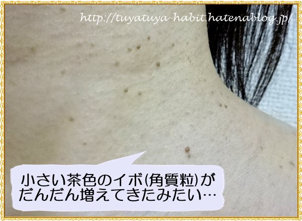艶つや習慣 アクアビューティー 茶色ポツポツ角質粒を取るオールインワン
