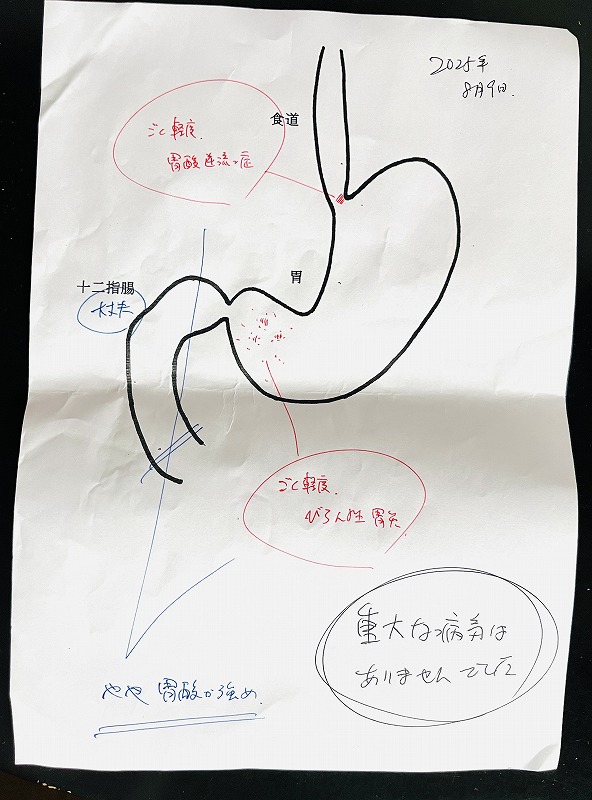 胃カメラ検査結果