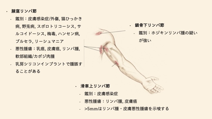 リンパ節が腫れているかどうかはどうやってわかりますか?