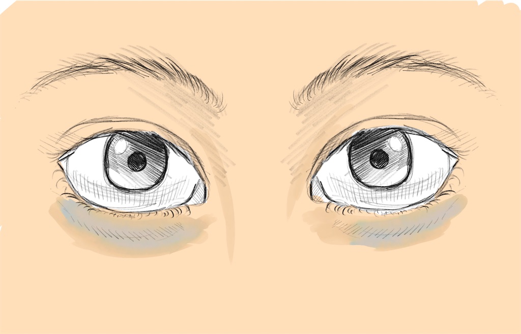 男性必見 目の下のクマの原因と取り方 クマをなおす薬は Lucy S Blog