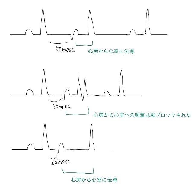 f:id:tyning:20200829233744j:plain f:id:tyning:20200829233744j:plain