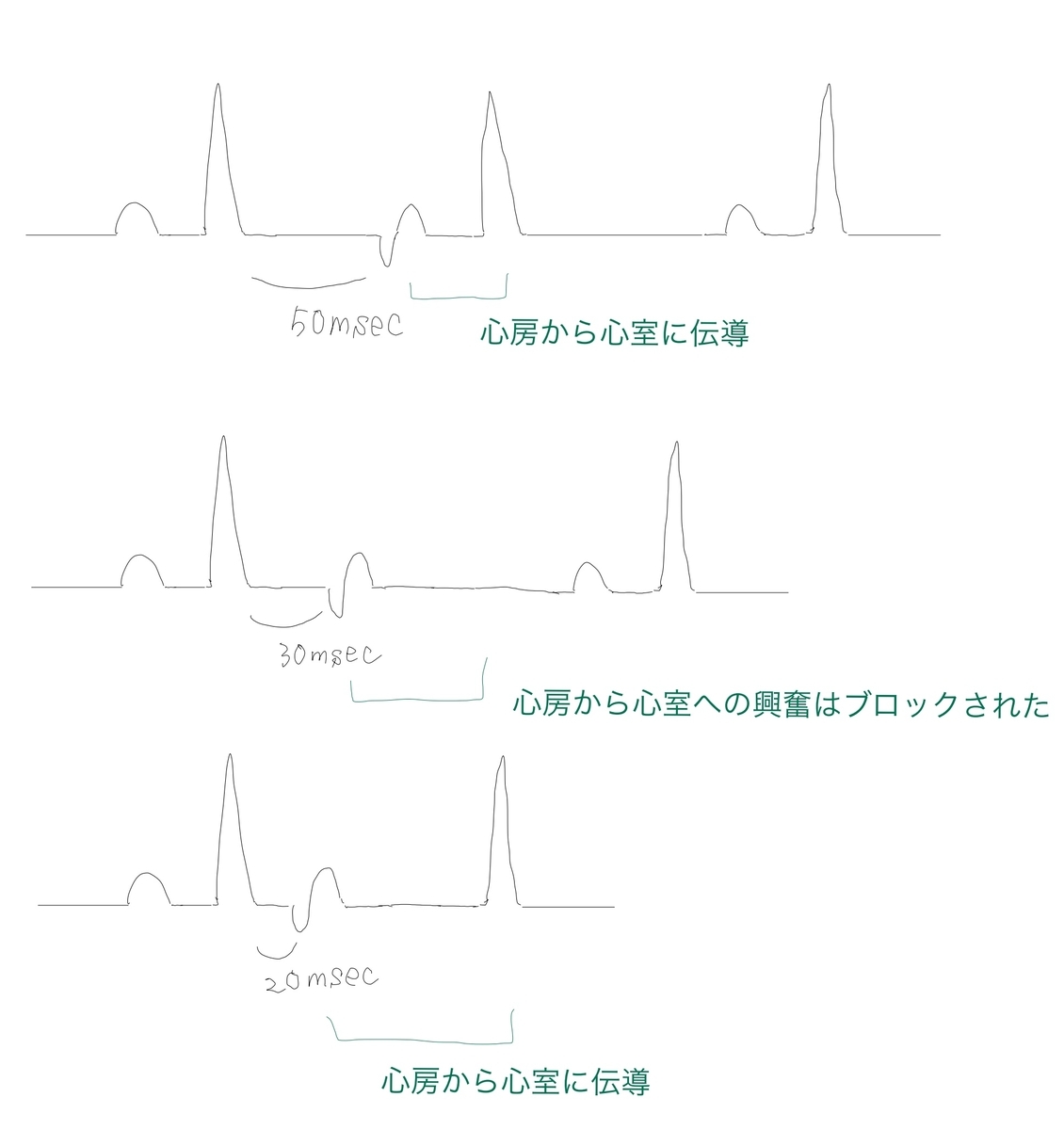 f:id:tyning:20200829233747j:plain f:id:tyning:20200829233747j:plain