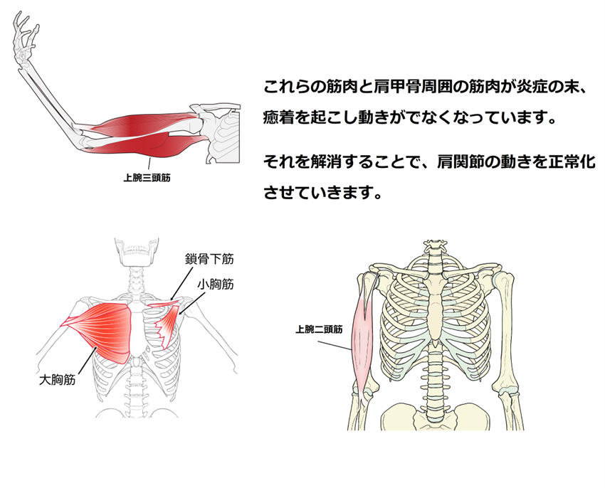 五十肩　八尾　整体　四十肩　肩の痛み