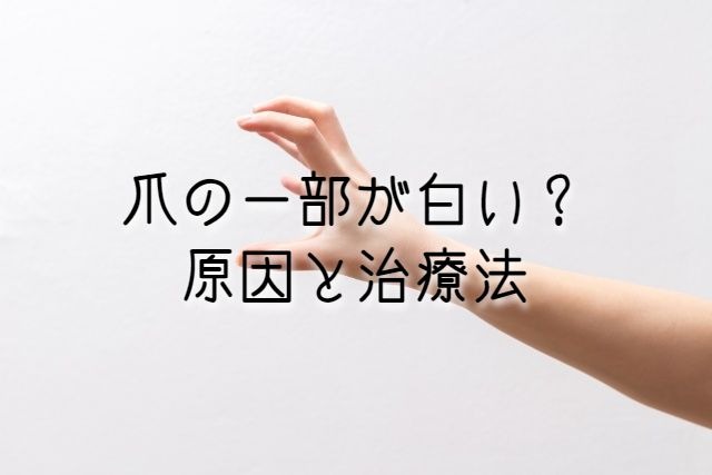 あれ 爪が白い 病気 点状や線状になった時の特徴と原因や治療法 うえのブログ あれ 爪が白い 病気 点状や線状になった時の特徴と原因や治療法 うえのブログ