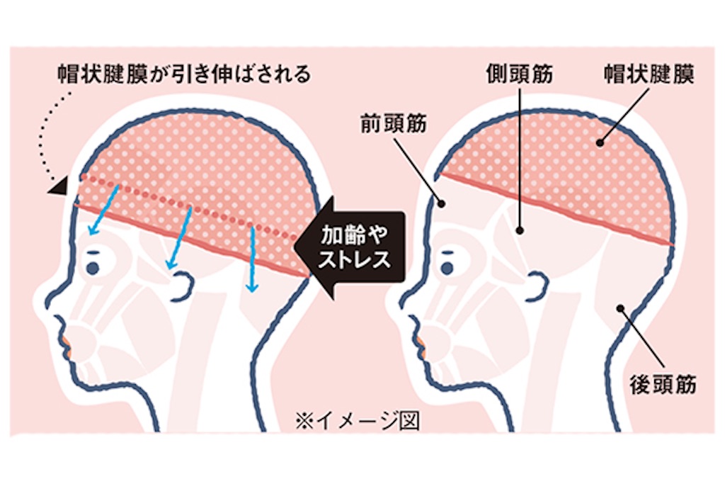 f:id:umestitch:20221120211509j:image