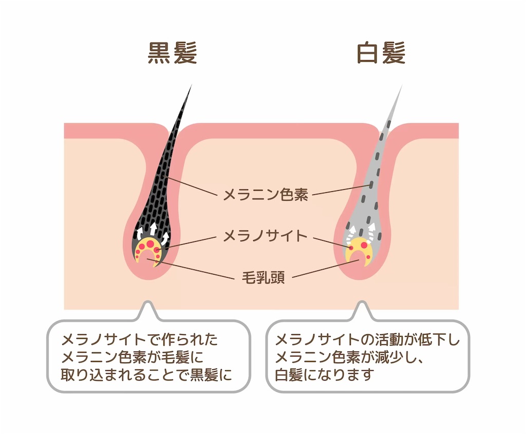 f:id:umestitch:20221121180624j:image