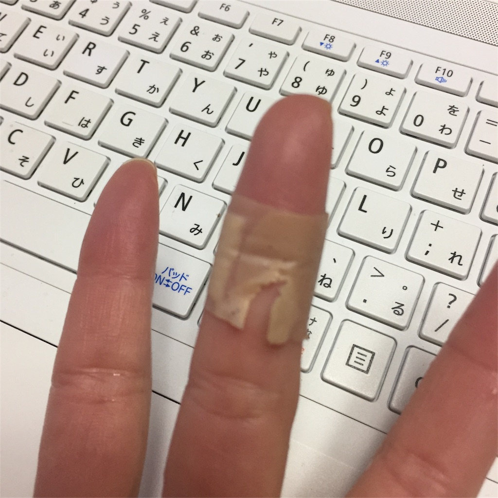 f:id:unitten:20171201090213j:image
