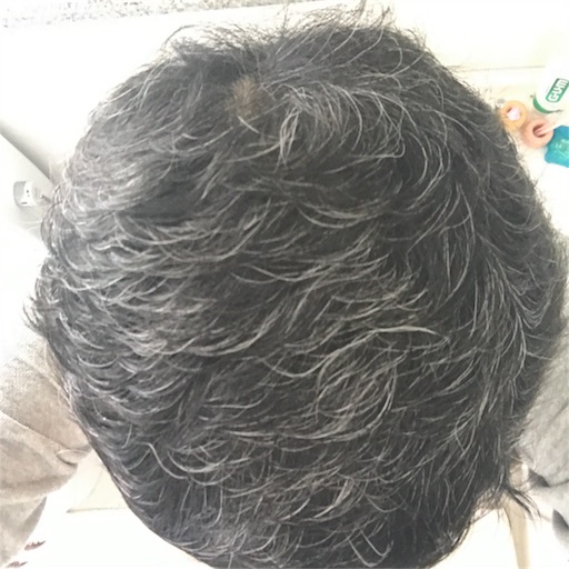 カラーをした なんとかなる