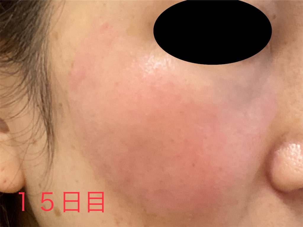 f:id:usagitonokurashi:20230323135406j:image