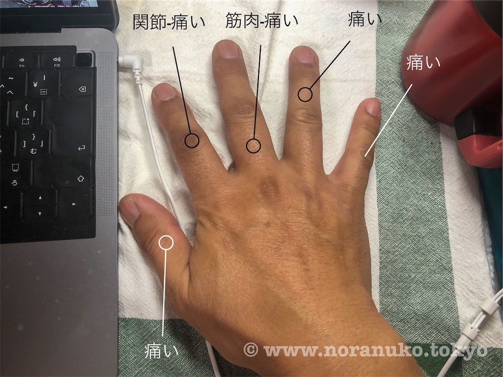 f:id:usakohiroshi242:20200308114946j:image