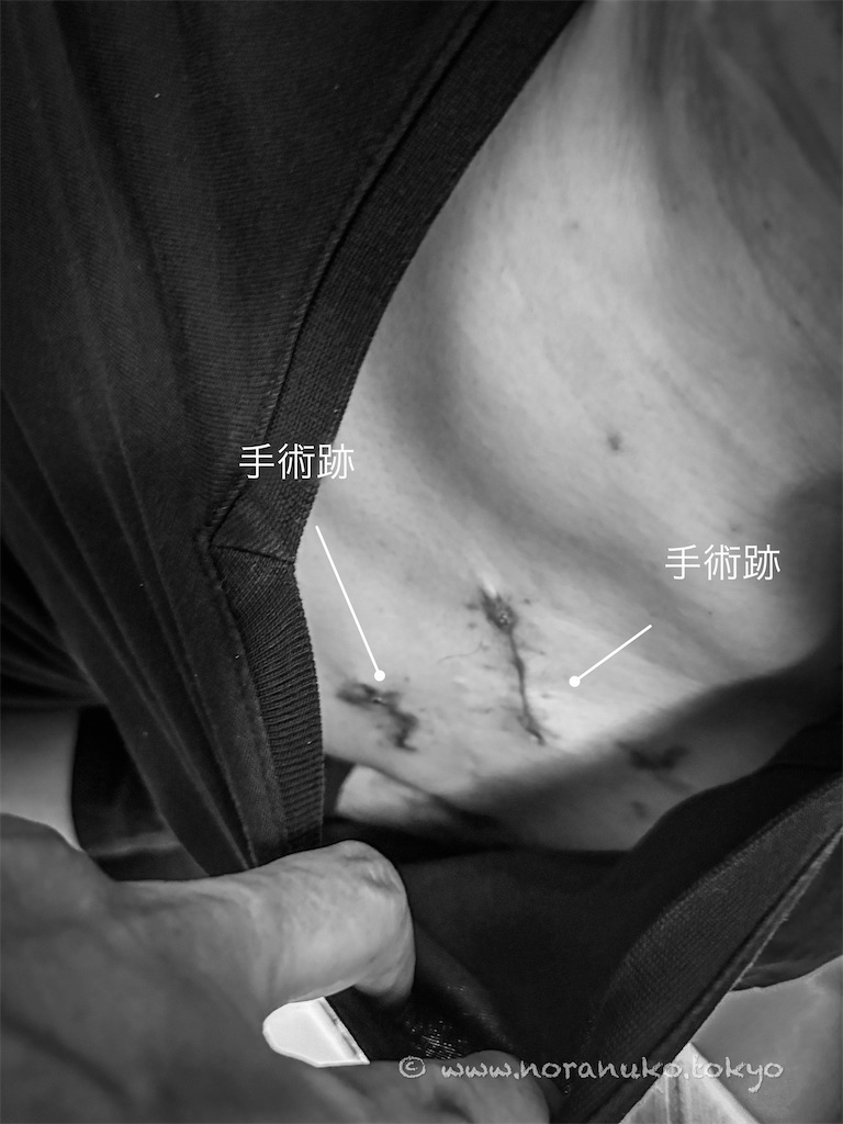 f:id:usakohiroshi242:20250618192520j:image