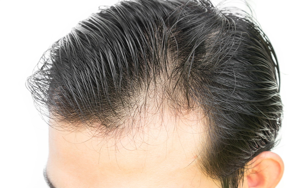 いいねヘアケアラボ東京院に通ったらどんな効果があるのか?調べてみた