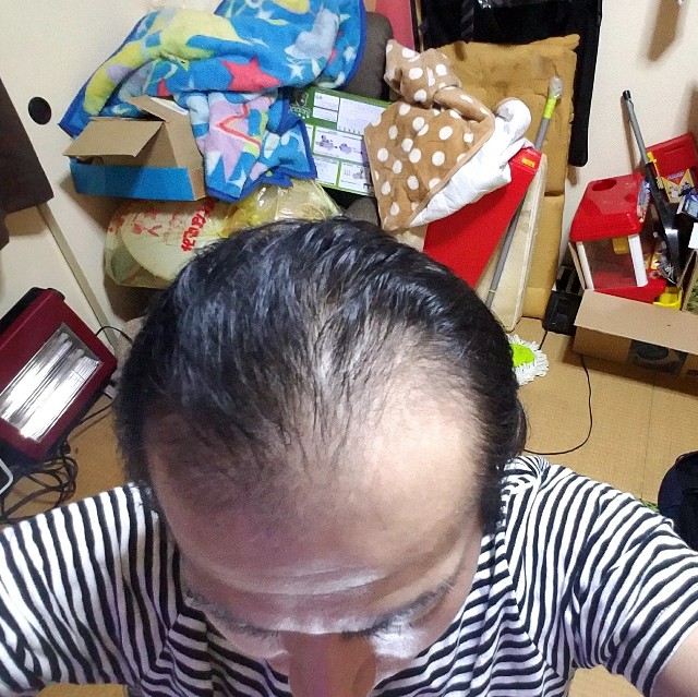 f:id:usugeman:20180620020351j:plain f:id:usugeman:20180620020351j:plain