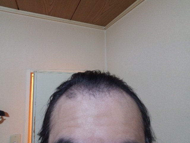 f:id:usugeman:20190316020448j:plain f:id:usugeman:20190316020448j:plain