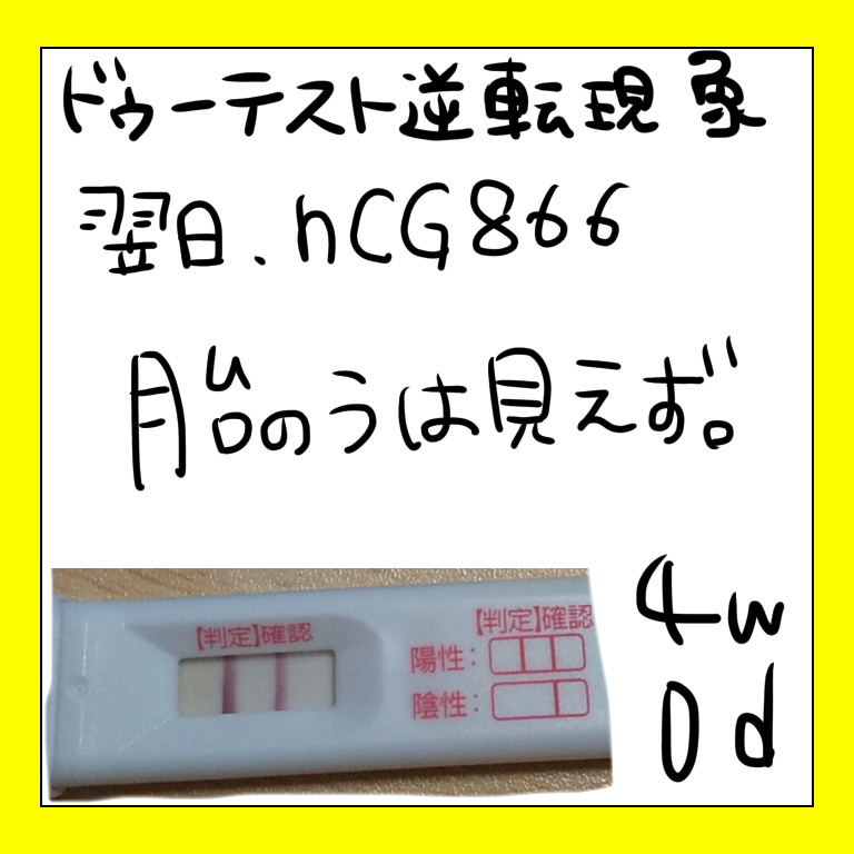 ドューテスト　逆転現象　胎嚢確認出来ない