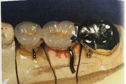 f:id:v33-MDDT:20181016152638p:plain