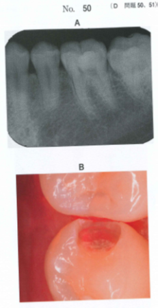 f:id:v33-MDDT:20181116164927p:plain