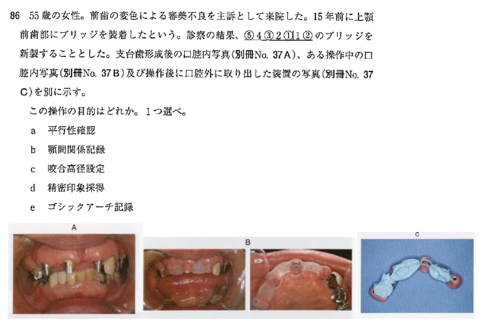 補綴臨床Practice Selection入門咬合学 ogpcover.ashx?bookcode=464000