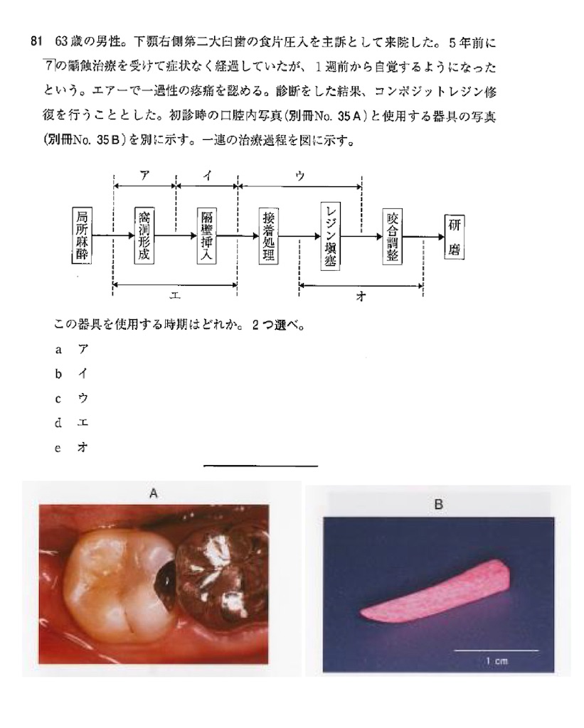 f:id:v33-MDDT:20210528074321j:image f:id:v33-MDDT:20210528074321j:image