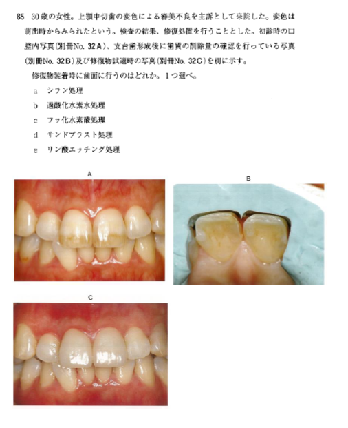 f:id:v33-MDDT:20210816095226p:plain