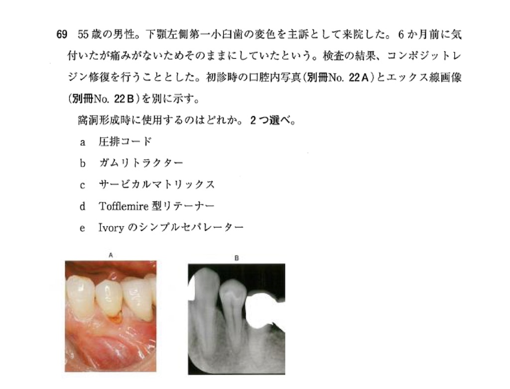 保存修復学 保存修復学21 第六版 | 田上 順次, 奈良 陽一郎, 山本 一世