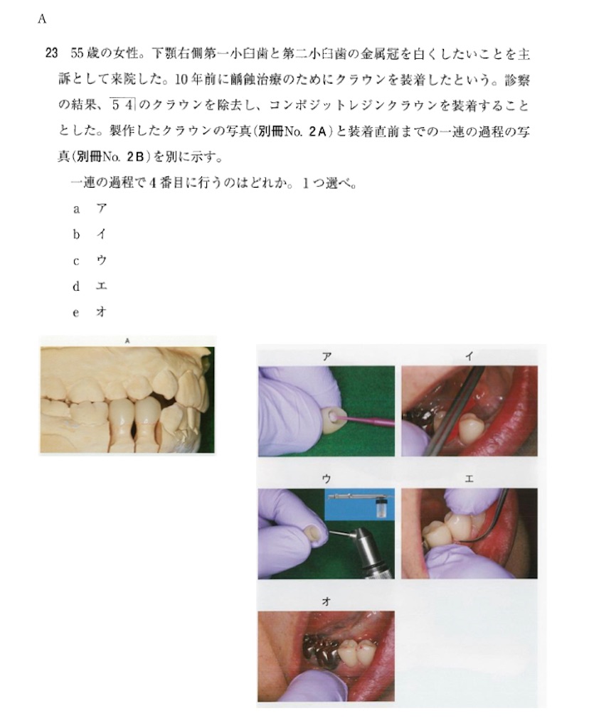 115回歯科医師国家試験【115A-23】歯間補綴学 CAD/CAM装着手順