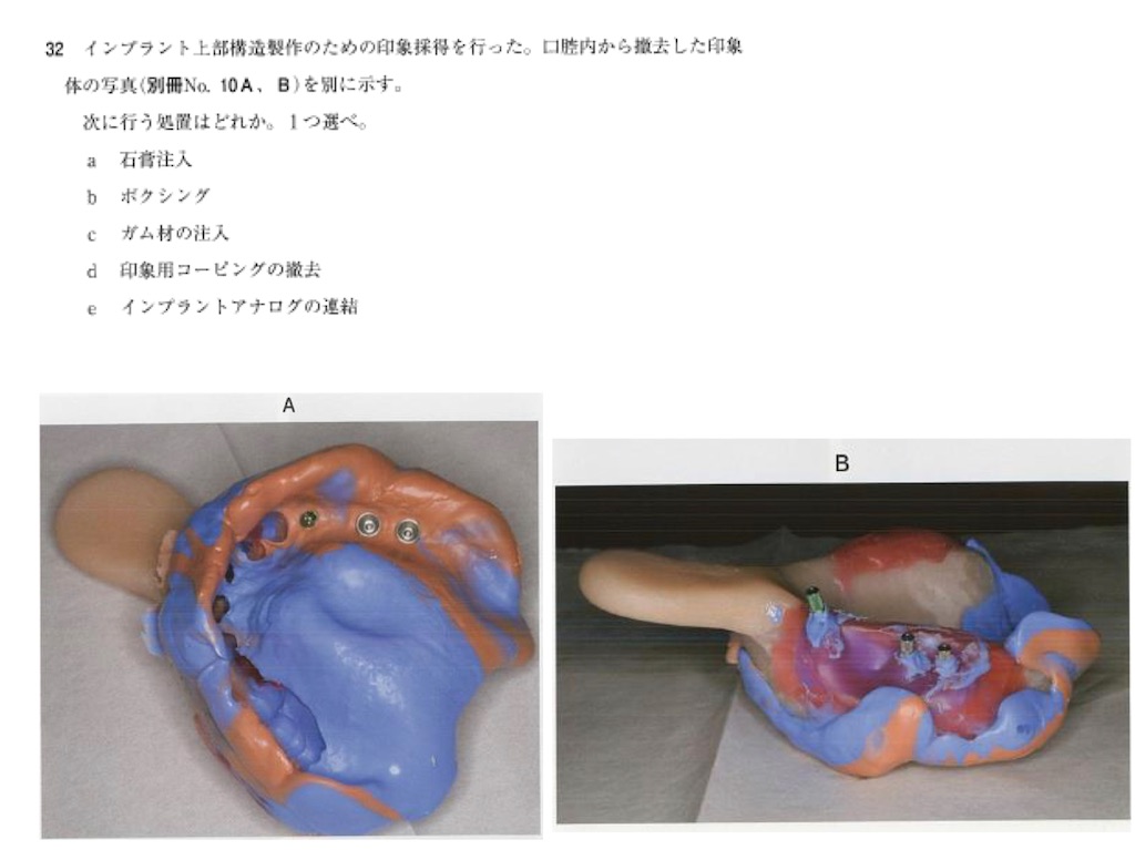歯科医　印象用トレー 37個 歯科医 印象用トレー 37個 （小児/矯正用トレー | 商品詳細_仕様