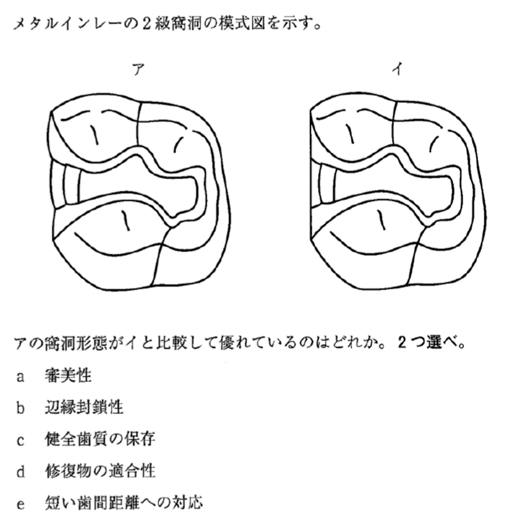 116回歯科医師国家試験【116B-56】保存修復学：スライスカット編 - 歯科材料のツボ