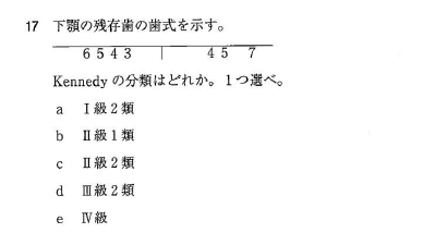 116回歯科医師国家試験【116B-17】義歯：ケネディの分類編