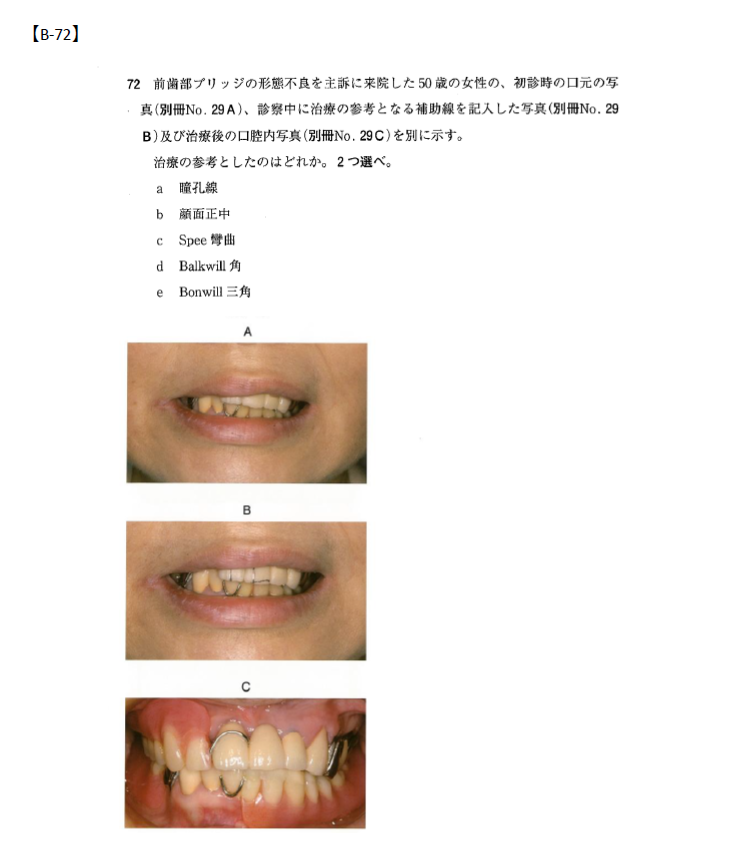 テスト付き！116回歯科医師国家試験対策 まずはこれ！】第116回国試問題