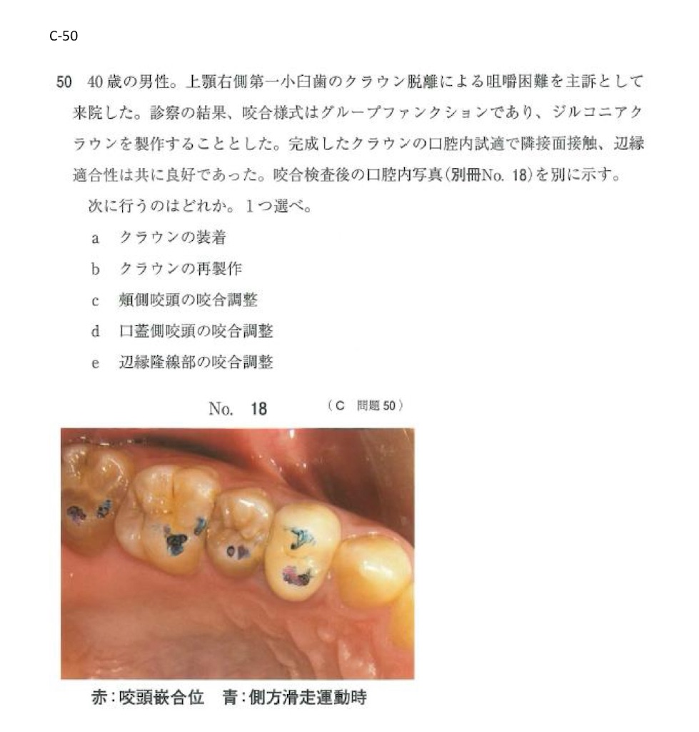 補綴治療に必要な咬合の基礎知識 : 迷ったら原点に戻ろう　裁断済み 楽天ブックス: 補綴治療に必要な咬合の基礎知識 - 迷ったら原点