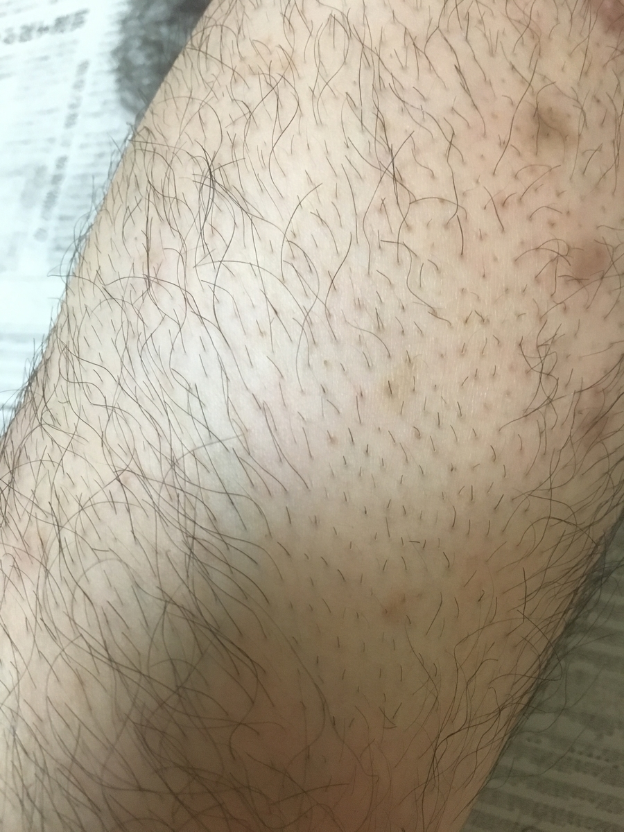 f:id:vagusnerve:20190609225512j:plain