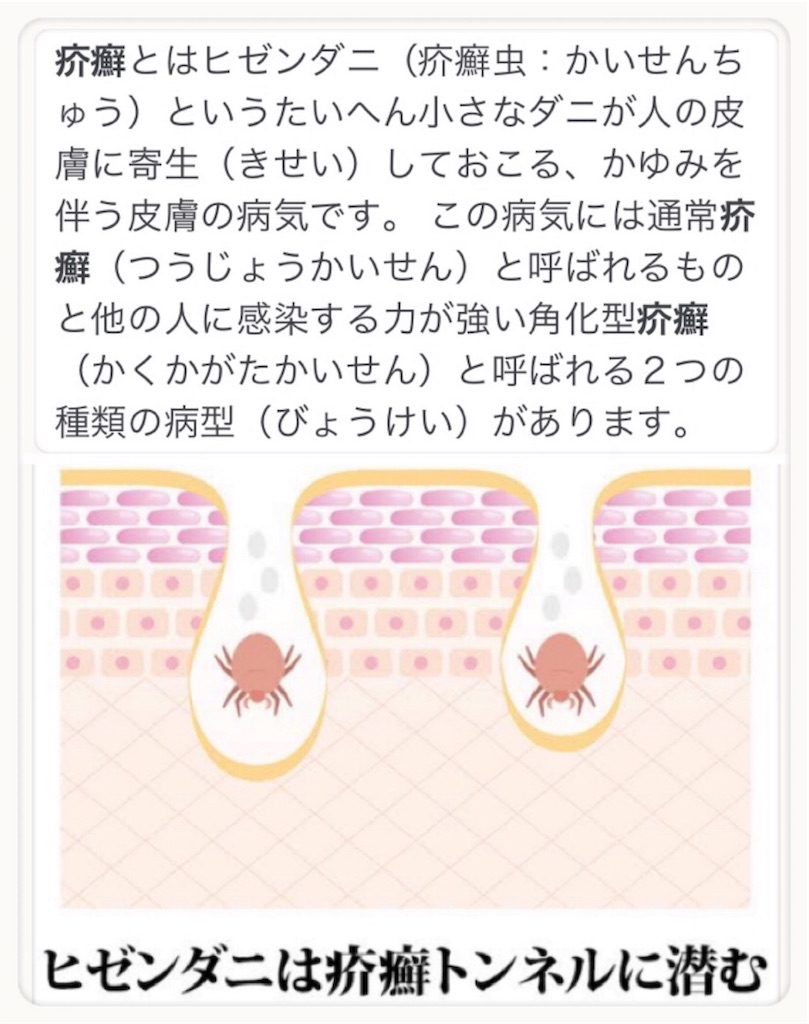 f:id:vivieng-me:20200215193855j:image f:id:vivieng-me:20200215193855j:image