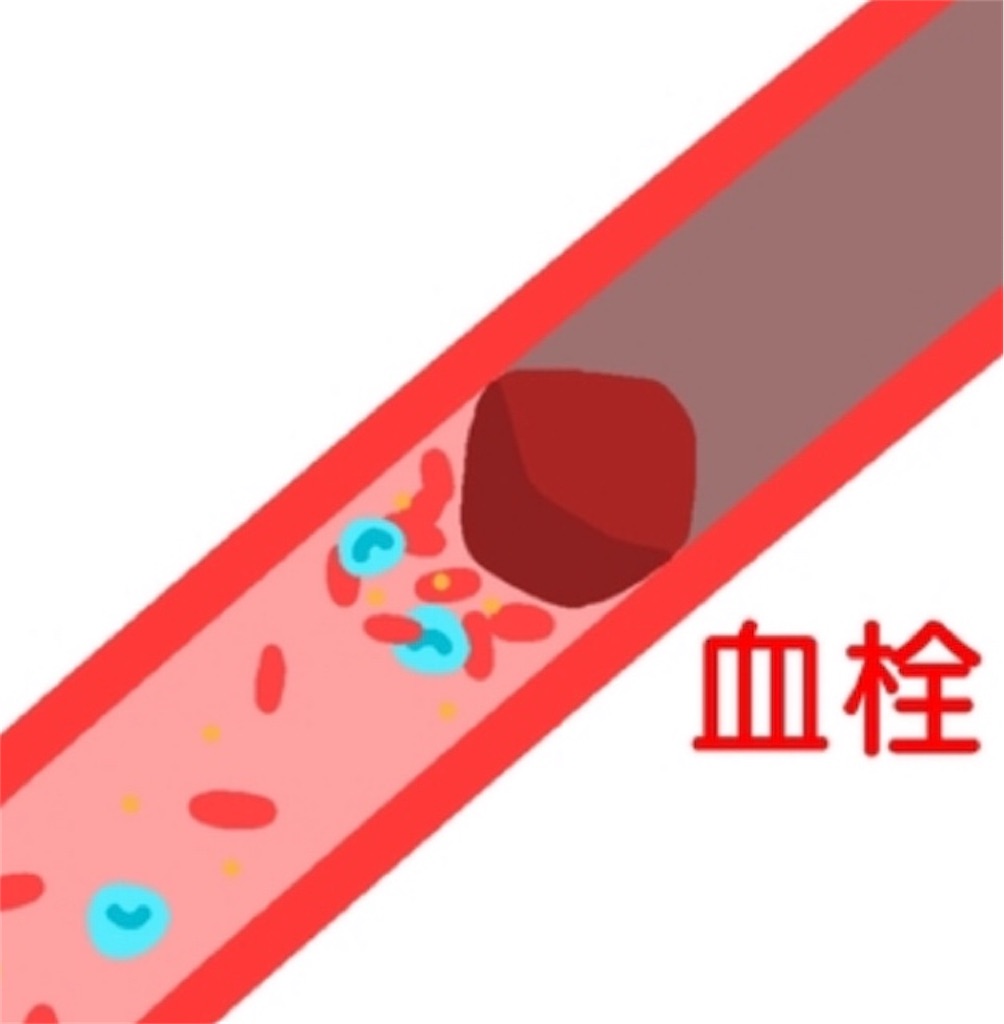 f:id:vivieng-me:20220929172128j:image