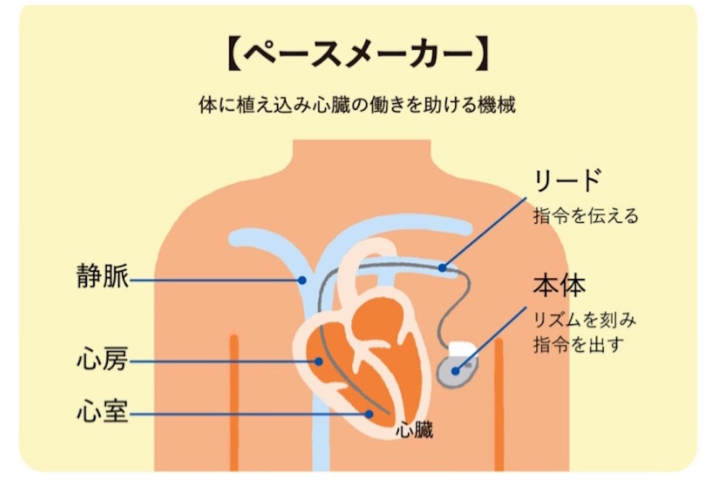 f:id:vivieng-me:20230113215340j:image f:id:vivieng-me:20230113215340j:image