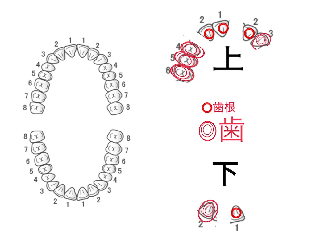 f:id:vivieng-me:20260829084158j:image f:id:vivieng-me:20260829084158j:image
