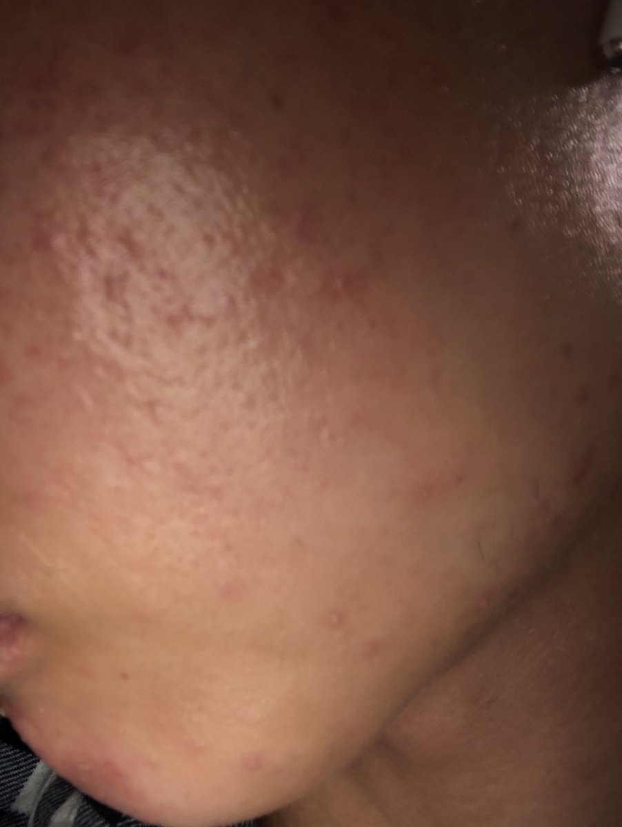 f:id:voici-spontex:20190411211217j:plain f:id:voici-spontex:20190411211217j:plain