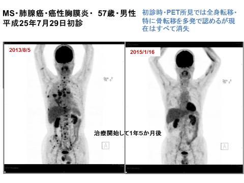 20150922182515