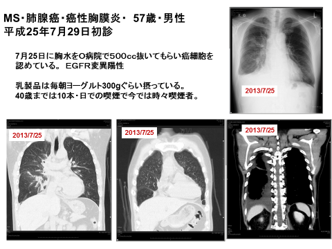 20150922182519