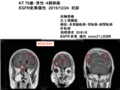 20161107200644