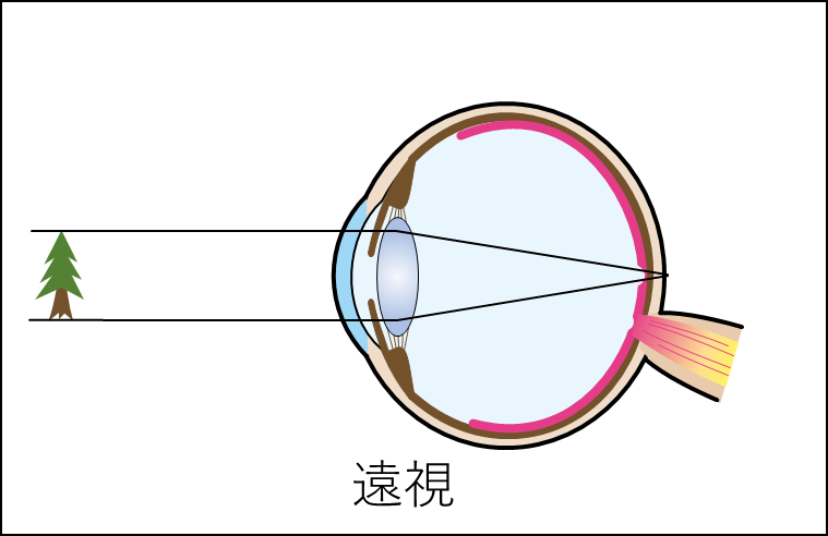 f:id:wakajibi2:20220322091703p:plain