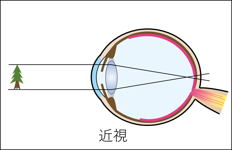 f:id:wakajibi2:20220322093100p:plain
